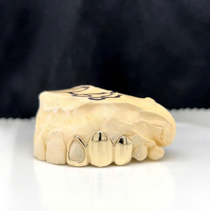 3 SOLID SILVER GRILLZ SET