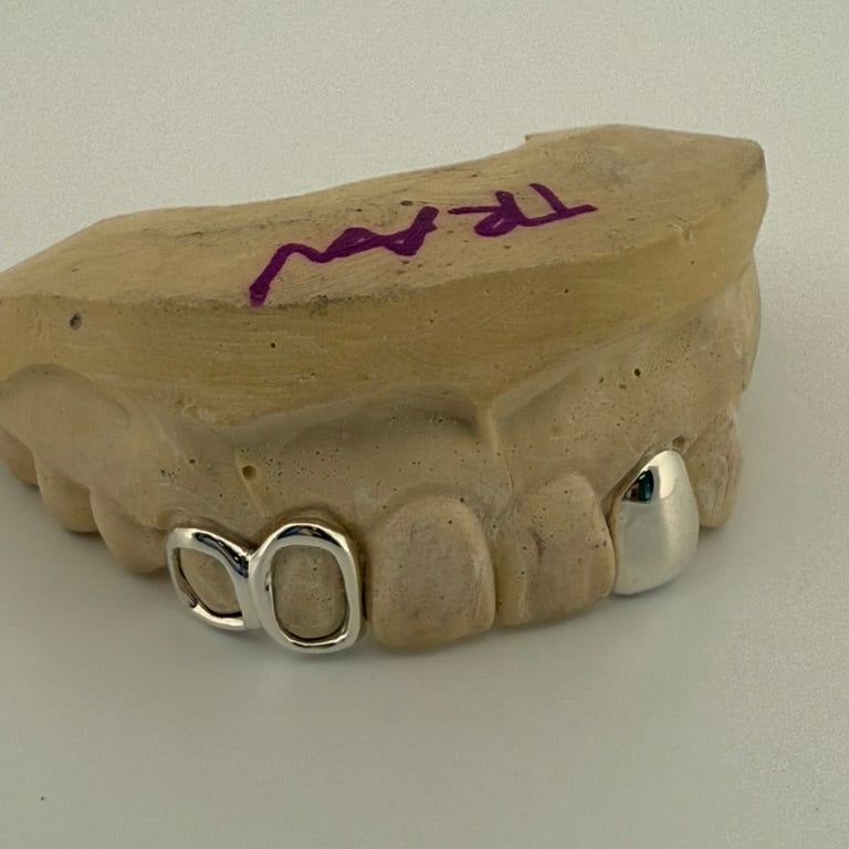 3 CUSTOM SOLID GRILLZ BAR BACK WITH 2 OPEN FACE