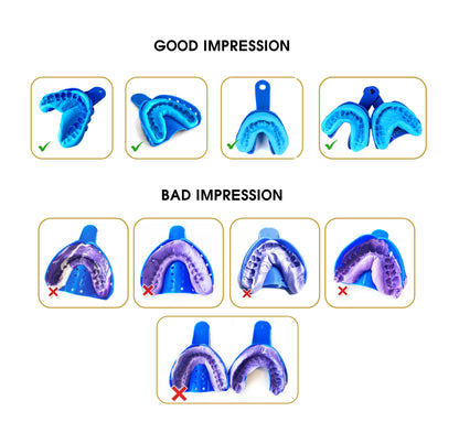 MOLD KITS