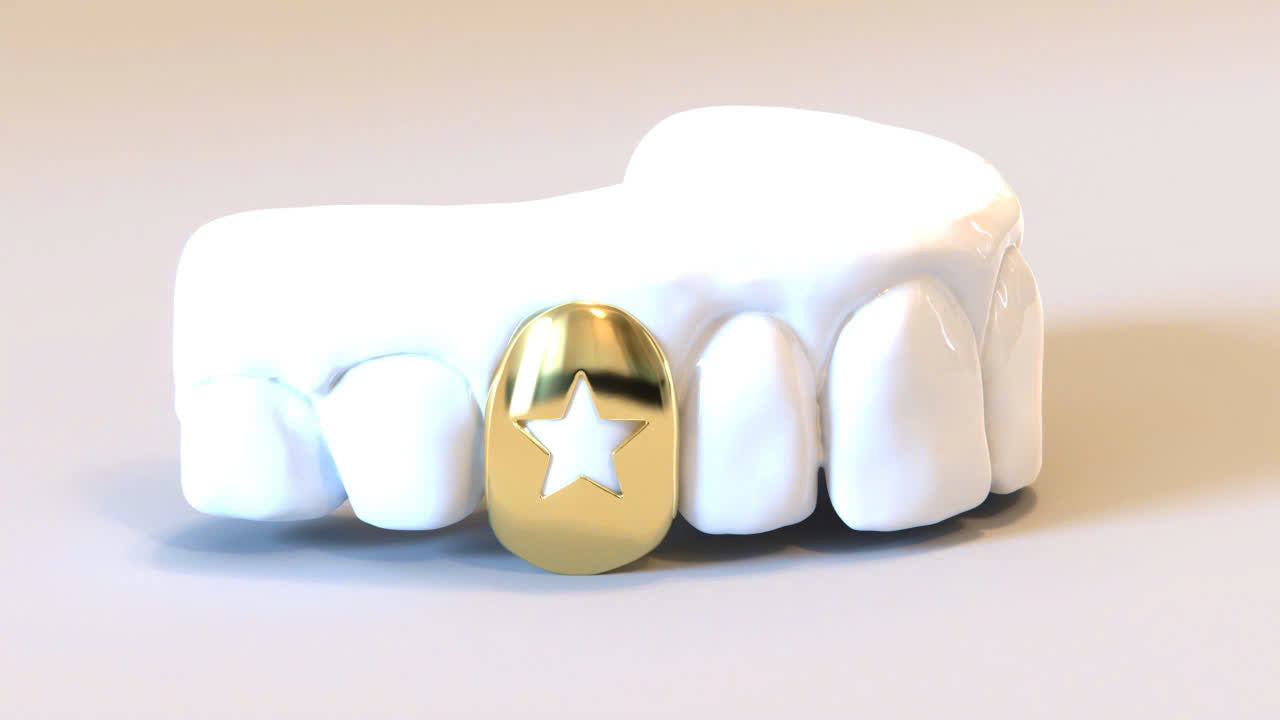 STAR CUT CUSTOM SOLID GRILLZ CAPS