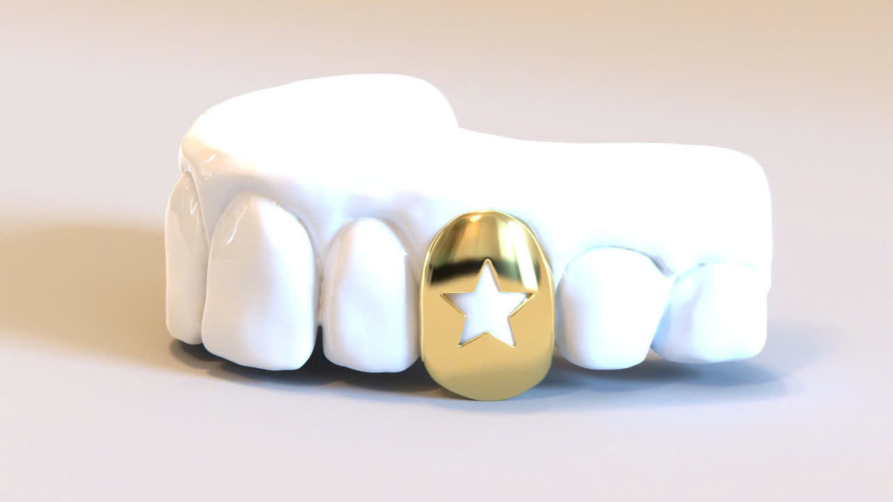 STAR CUT CUSTOM SOLID GRILLZ CAPS